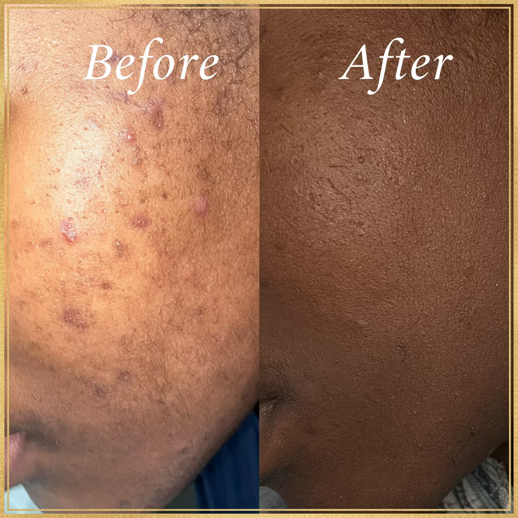 Facial Steamer